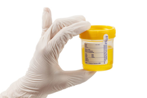 A gloved hand holds a urine sample for drug testing.