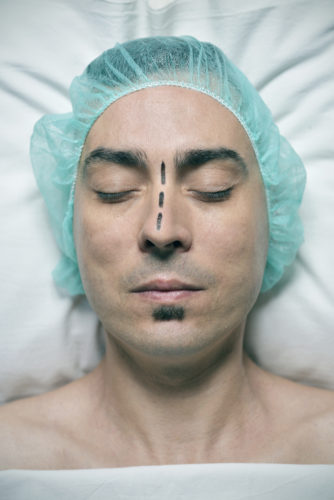 A man with a surgery cap and a marked up nose about to receive deviated septum surgery.