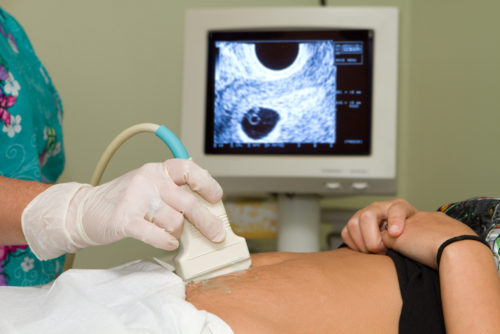 An OB-GYN performing an ultrasound on a pregnant woman.